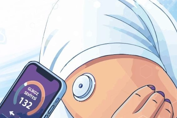 Bursa'da 18 Yaş Üstü Diyabetli Öğrencilere Sensör Desteği Başvuruları Başladı