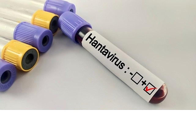 Hantavirüs Pandemiye Dönüşür mü? Uzmanlar Endişeli Değil
